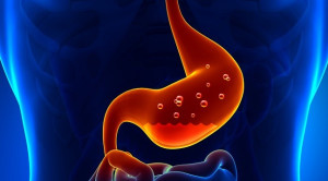 Untung Rugi Penggunaan Acid Suppressant pada Dyspepsia