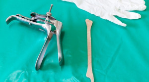 Tes HPV DNA Lebih Direkomendasikan untuk Skrining Kanker Serviks