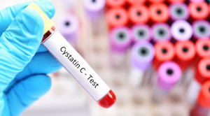 Estimasi Laju Filtrasi Glomerulus dengan Pemeriksaan Cystatin-C