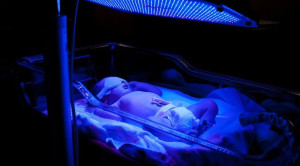 Fototerapi dan Peningkatan Risiko Kanker