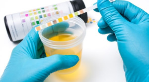 Tes Dipstick untuk Skrining Infeksi Saluran Kemih Anak