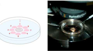 Jenis Pengobatan Infertilitas