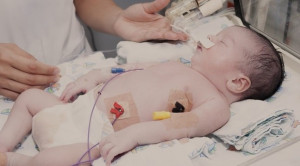 End of Life Decision pada Neonatus