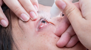 Mengapa Antibiotik Masih Diberikan pada Konjungtivitis Virus?