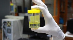 Antibiotik Untuk Bakteriuria Asimtomatik pada Resipien Transplantasi Ginjal