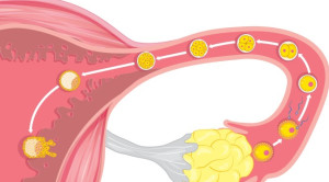 Memprediksi Ovulasi pada Menstruasi Ireguler