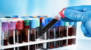 Pemilihan Tabung Sampel pada Pemeriksaan Patologi Klinik Darah