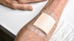 Keuntungan Perawatan Luka Kronis dengan Balutan Hidrokoloid