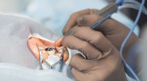 Pemilihan Lensa Tanam Operasi Katarak