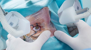 Indikasi Laser Iridotomy Peripheral pada Glaukoma