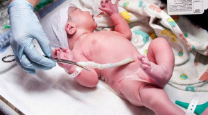 Manfaat Penundaan Penjepitan Tali Pusat