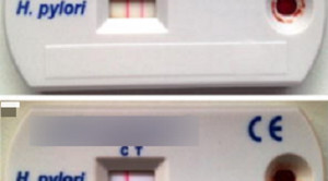 Tes Noninvasif untuk Diagnosis Infeksi Helicobacter pylori
