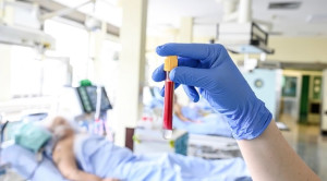 Prokalsitonin Vs C-Reactive Protein Sebagai Penanda Sepsis di ICU