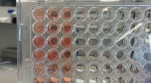 Membedakan Infeksi Bakteri dan Virus dengan Tes Host Protein Assay