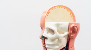 Kapan dilakukan Tindakan Non Operatif pada Perdarahan Intraserebral Traumatik dan Kontusio Serebri?