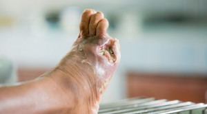 Asam Hialuronat sebagai Terapi untuk Luka Kronik