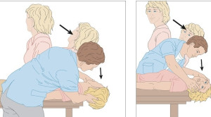 Efikasi Manuver Epley untuk Benign Paroxysmal Positional Vertigo