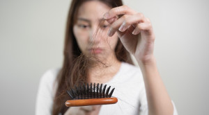 Red Flags Rambut Rontok