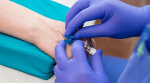 Penggantian Kateter Intravena Berkala vs Sesuai Indikasi Medis