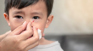 Peran Kauterisasi dalam Tata Laksana Epistaksis Anterior