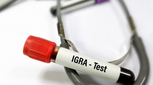 Pemeriksaan IGRA dalam Diagnosis Tuberkulosis pada Penderita HIV