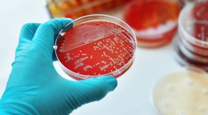 Mengatasi Resistensi Antibiotik terhadap Gonorrhea