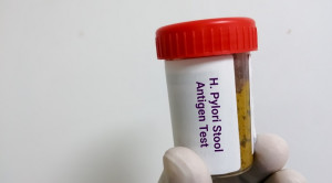 Pemeriksaan HpSA untuk Diagnosis Infeksi Helicobacter pylori