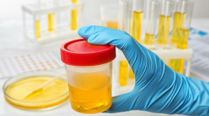 Positif dan Negatif Palsu pada Tes Urine Narkoba untuk Deteksi Penyalahgunaan Zat