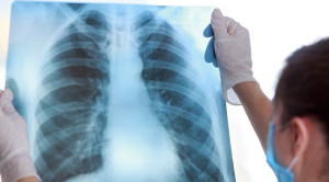 Peran Artificial Intelligence Terhadap Akurasi Interpretasi Rontgen Toraks – Telaah Jurnal Alomedika