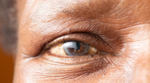 Efikasi Suplemen Lutein pada Penyakit Mata Degeneratif