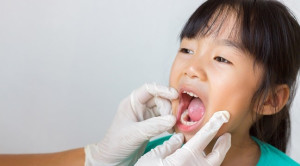 Manajemen Faringitis Streptococcus Grup A Berdasarkan Sistem Skoring Klinis