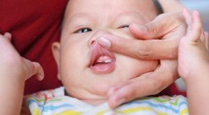 Kontroversi Seputar Lip Tie