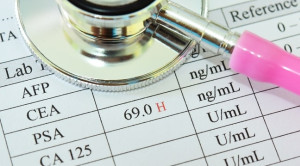 Potensi Risiko Skrining Prostate Specific Antigen (PSA)