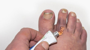 Bukti Ilmiah Terkait Efikasi Heparin Topikal untuk Cedera Benturan