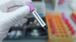 Perbedaan PCR GeneXpert MTB/RIF Konvensional dan Ultra untuk Diagnosis Tuberkulosis – Artikel Terkini!