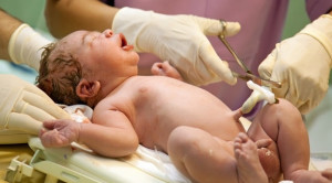 Teknik Mencegah Hipotermia pada Neonatus