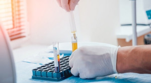 Efek Injeksi Platelet-Rich Plasma pada Osteoarthritis Pergelangan Kaki – Telaah Jurnal Alomedika