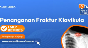 Terapi Konservatif vs Pembedahan pada Fraktur Klavikula