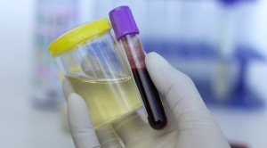 Pemeriksaan Kehamilan dengan Sampel Urine pada Unit Gawat Darurat