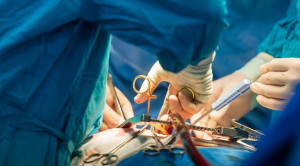 Pembedahan Dini untuk Regurgitasi Trikuspid Parah yang Terisolasi – Telaah Jurnal Alomedika