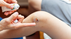 Asam Hialuronat Topikal Untuk Meningkatkan Penyembuhan Luka