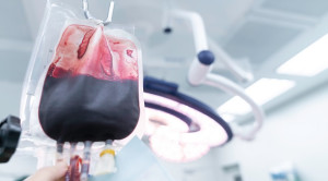Pengaruh Usia Donor Transplantasi Sel Punca Hemopoietik pada Kasus Leukemia Akut