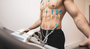 Tes Stres EKG untuk Menilai Disfungsi Mikrovaskular Koroner – Telaah Jurnal Alomedika