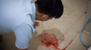 Pedoman Pencitraan pada Kasus Perdarahan Gastrointestinal 2024 – Ulasan Guideline Terkini