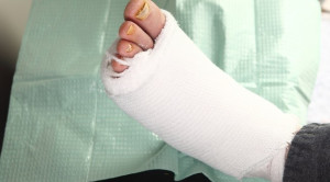 Efektivitas Madu sebagai Balutan Ulkus Diabetikum