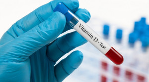 Hentikan Pemeriksaan Rutin Kadar Vitamin D