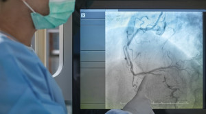 Perlu Tidaknya Puasa Sebelum Kateterisasi Jantung – Telaah Jurnal Alomedika