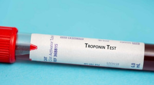 Pemeriksaan Troponin 0 dan 2 Jam Untuk Kecurigaan Infark Miokard Akut – Telaah Jurnal Alomedika