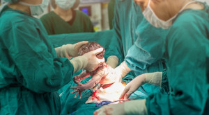 Asam Traneksamat untuk Pencegahan Perdarahan Setelah Sectio Caesarea