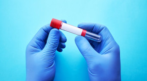 Efek Penggunaan Tabung Sampel Darah yang Lebih Kecil Terhadap Kebutuhan Transfusi pada Pasien ICU – Telaah Jurnal Alomedika